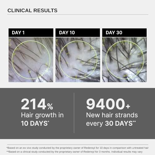 Bare Anatomy Advanced Hair Growth Serum | 3% Redensyl + 4% Anagain + 3% Baicapil + 1% Capilia Longa, Rosemary, Biotin & Rice Extract | Hair growth & Hair fall control serum for Women & Men | 30mL