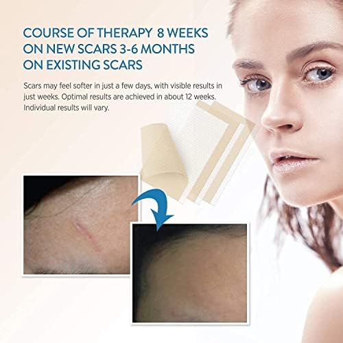 Aroamas Scar Silicone Scar Tape– Softens & Flattens Scars from Surgery, Injury, Burns, C-Section, Scratch Marks – Reusable Medical-Grade Silicone Scar Sheets for All Skin Types [3"x1.57", 8 Sheets]