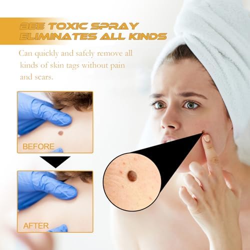 Tag Recede Bee Venom,2025 Tag Recede, TagRecede,Tag Recede Bee Venom Spray for All Skin Types(3PCS)