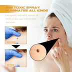 Tag Recede Bee Venom,2025 Tag Recede, TagRecede,Tag Recede Bee Venom Spray for All Skin Types(3PCS)