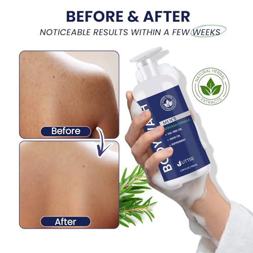 Tea Tree Body Wash: Antifungal Soap for Men - Eliminates Body Odors & Skin Irritations - 11.8fl oz/350mL