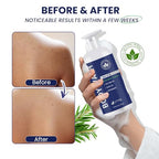 Tea Tree Body Wash: Antifungal Soap for Men - Eliminates Body Odors & Skin Irritations - 11.8fl oz/350mL