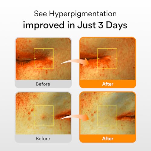 Abib Glutathiosome dark spot serum Vita drop 50ml / 1.69 fl.oz. | Korean Skincare, Dark Spot, Hyperpigmentation Treatment | Brightening Serum for Sensitive, Uneven Skin | Niacinamide, Viatmin C