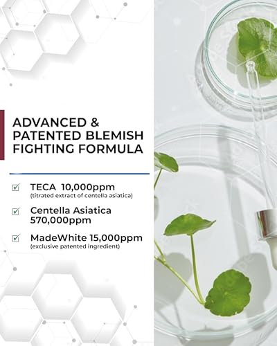 Centellian 24 Expert Ampoule (Season 2, 0.2fl oz x 4 pcs) - Korean Serum for Face. Soothing, Even Tone, Dry Sensitive Skin. TECA, Centella Asiatica, Gotu Kola