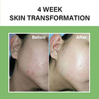 celimax Noni Energy Ampoule 30ml + The Real Noni Energy Repair Cream 50ml + Noni Acne Bubble Cleanser 155ml Bundle
