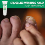 Toenail Soft Temporary Nail Softening Cream for Thick, Hard Toenails with Aloe 1 Oz