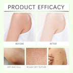 Neuropathy Cream, Magnesium Body Butter, Magnesium Cream, Deeply Moisturizes Skin, Keep Soft Smooth Lotion, Suitable for All Skin Types (2PC, 1)