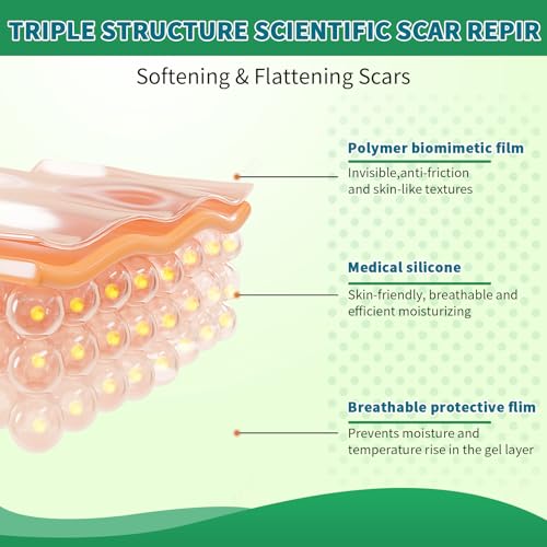 Silicone Scar Sheets, Silicone Scar Tape, Scar Sheets for Surgical Scars, Reusable Silicone Scar Strip For Surgical, C-Section,Tummy Tuck, Keloid Scars, Burn, Acne, Removal (1.6"X 108" Roll-3M)