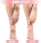 Tarpop 3 Pairs Aloe Socks Women Moisturizing Spa Socks for Dry Cracked Heel Feet Infused Gel Sleeping Fuzzy Lotion Valentines Day Gift for Women Men Softening Dry Feet(Pink)