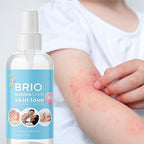 BRIOTECH Babies & Kids Skin Love, Soothing Hypochlorous Acid Spray, Pure HOCl for Sensitive Skin, Calm Redness & Bumps, Support Against Diaper Irritation, Gentle & Vegan, 4 fl oz