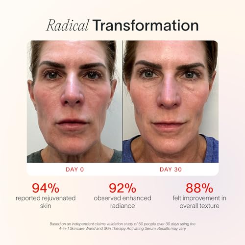 Solawave 4-in-1 Radiant Renewal Facial Wand | Red Light Therapy for Face and Neck | Galvanic Skincare Wand & Facial Massager | Anti-Aging Wrinkle Reduction | Solawave Original