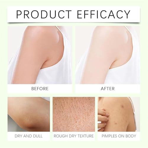 Neuropathy Cream, Magnesium Body Butter,Magnesium Cream for Neuropathy, Deeply Moisturizes Skin, Keep Soft Smooth, Suitable for All Skin Types (white1pc, 4 Fl Oz (Pack of 1))