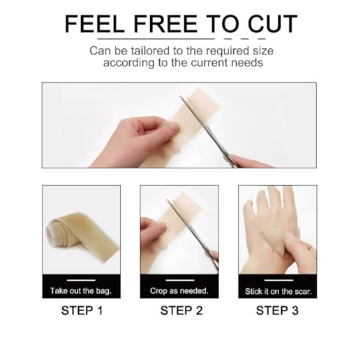 Losveo Silicone Scar Sheets For Face Wrinkles, 1.6”x 120”/3m Collagen Scar Tape Strips for Face,Medical Grade Silicone Scar Sheets for Surgical Scars,C-Section, Burn, Scars- Reusable(1box/3m)