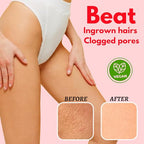 Bikini Area Exfoliator, 2% Kojic Acid Vitamin C & 7% AHA/BHA Even Skin Tone & Ingrown Hair - Underarm Scrub - Radian, Smoothe & Soften Body Scrub