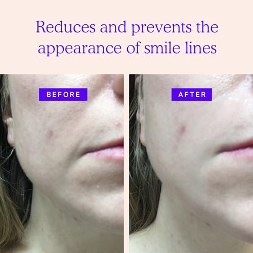 BLUMBODY Face Wrinkle Patches - Anti Wrinkle Facial Patches to Smooth Smile Lines - Non-Silicone Face Patches Wrinkles Tape for Fine Wrinkles between Eyes & Face - For Overnight Wrinkle Use