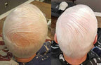 Zenagen Revolve Thickening Hair Loss Treatment for Men
