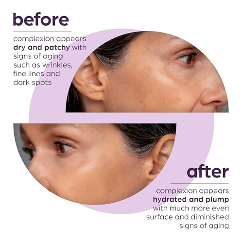 50% Beta Glucan Serum | Anti-Aging, Hydrating & Plumping for Dry Skin, Fine Lines, Wrinkles, Dark Spots | Niacinamide, Centella, Hyaluronic Acid | Korean Skincare | Lightweight, Non-Greasy