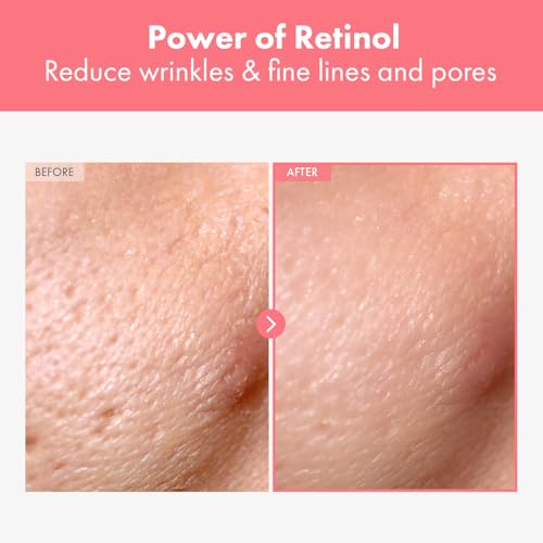 Repair Retinol Cream, Liposomal Retinol 0.1%, Bakuchiol, Retinal, niacinamide, Anti Aging for Face, Eye, Fine Lines & Wrinkles Treatment, Pure Vitamin A, Korean Skincare, 50g, 1.76 oz.