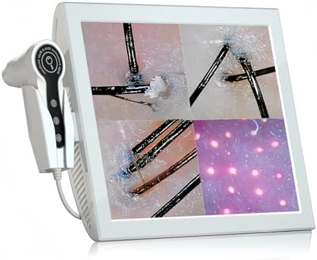 Professional 15-Inch Scalp Camera for Beauty Salons – High-Resolution Hair and Scalp Analysis Device with Image Storage, Easy Assembly, Durable Build, Ideal for Client Consultations & Head Spa