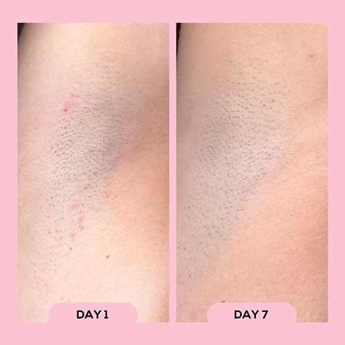 Megababe Après Shave | Post-Shave & Waxing | Ingrown Hair & Razor Bump Roll-On Treatment for Women | Bikini, Armpits & Legs | 3.0 fl oz