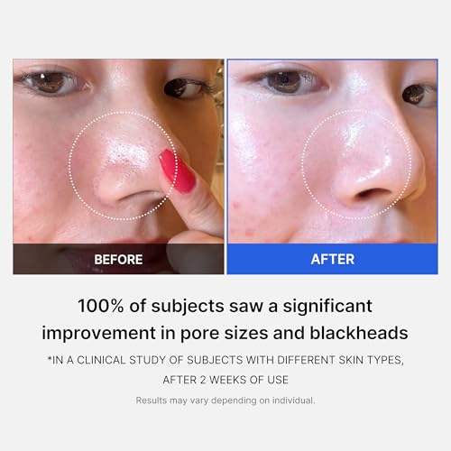 medicube All-in-One Duo for Pore and Skin Texture Care: Zero Pore Pads 2.0 and Zero Pore Blackhead Mud Facial Mask