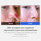 medicube All-in-One Duo for Pore and Skin Texture Care: Zero Pore Pads 2.0 and Zero Pore Blackhead Mud Facial Mask