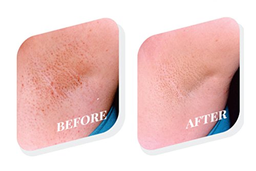 Tend Skin Womens AfterShave/Post Waxing Solution for Ingrown Hair, Razor Bumps and Burns, 4 ounce, Blue