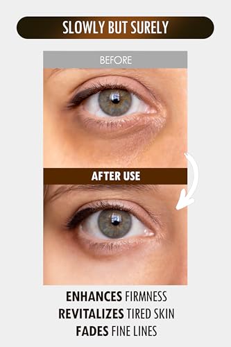 24K Gold Perfection All In One Cream for Face & Eye with Hyaluronic Acid, Panthenol and 24 Gold 1.18 oz