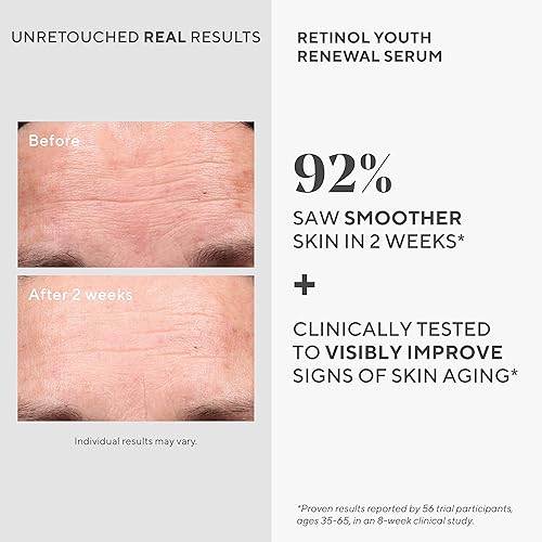 Murad Retinol Youth Renewal Serum - Fast-Acting Retinol Serum for Face and Neck - Visibly Improves Lines and Wrinkles, Skin Looks Firmer and Feels Smoother, Gentle Enough for Nightly Use