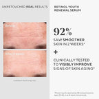 Murad Retinol Youth Renewal Serum - Fast-Acting Retinol Serum for Face and Neck - Visibly Improves Lines and Wrinkles, Skin Looks Firmer and Feels Smoother, Gentle Enough for Nightly Use
