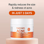 Acne Treatment for Face for Hormonal Cystic Stubborn Acne Cream for Sensitive Skin Teens Adults Women Men Spot Pimple Butt Control Rapid Clearing Breakout Overnight