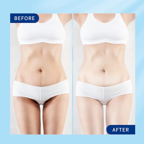 Skin Whitening Cream, Intimate Bleaching Cream for Women, Skin Lightening Cream for Dark Spots, Private Parts, Underarms, Elbows, Armpits, Knees, Inner Thighs