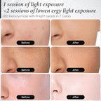 Red Light Therapy for Face, 7 Colors LED Face Mask Light Therapy At Home, Led Face Mask Light Therapy, Black