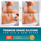 Silicone Scar Sheets, Silicone Scar Tape(1.6"x 120" Roll-300CM), Silicone Tape for Scars, Scar Tape for Surgical Scars, Silicone Scar Strips for C-Section, Tummy Tuck, Keloid, and Surgical Scars