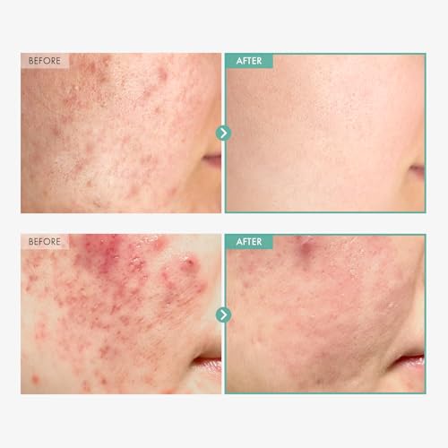 Dexpanthenol Cream, 170,000ppm B5 Panthenol, Madecassoside, Centella Asiatica for Skin Barrier Repair, Facial Moisturizer, Soothing, Hydrating, Korean Skincare, 60ml, 2.02 fl. oz.