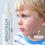 BRIOTECH Topical Skin Spray, Hypochlorous Acid Spray for Body & Face, Eyelid Cleanser, HOCl Facial Mist, Support Against Irritation, Calm Redness, Soothe Foot & Scalp, 8 fl oz ea, 2 ct