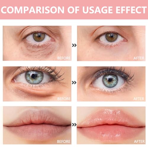30 Pairs Lip Mask & Eye Mask,Under Eye Patches for Reducing Fine Lines & Dark Circles,Collagen Crystal Lip Patches for Lip Spa Daily Labial Masks Hydrating Lip Treatment Christmas Gifts