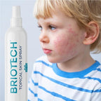 BRIOTECH Topical Skin Spray, Hypochlorous Acid Spray for Body & Face, Eyelid Cleanser, HOCl Facial Mist, Support Against Irritation and Redness, Packaging May Vary, 4 oz, 1 ct