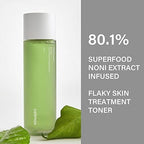 celimax Noni Moisture Balancing Toner | with Noni Extract, Facial Astringent, Hydrating, Exfoliating, Anti Aging, for Sensitive Dry Skin, Fine Lines, Korean Skincare, 150ml