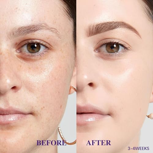 Advanced Dark Spot Remover for Face & Body - Effective Melasma & Hyperpigmentation Treatment - Fade Cream for Uneven Skin Tone - Suitable for All Skin Types - Natural Ingredients for Gentle Care