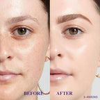 Advanced Dark Spot Remover for Face & Body - Effective Melasma & Hyperpigmentation Treatment - Fade Cream for Uneven Skin Tone - Suitable for All Skin Types - Natural Ingredients for Gentle Care