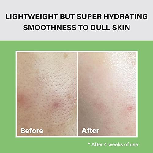celimax Noni Moisture Balancing Toner | with Noni Extract, Facial Astringent, Hydrating, Exfoliating, for Sensitive Dry Skin, Fine Lines & Wrinkles, 150ml