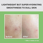 celimax Noni Moisture Balancing Toner | with Noni Extract, Facial Astringent, Hydrating, Exfoliating, for Sensitive Dry Skin, Fine Lines & Wrinkles, 150ml