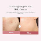 medicube Salmon DNA PDRN Pink Hyaluronic Moisturizing Cream, Pink Soothing Cream, Hyaluronic acid, Niacinamide, Hydrating & Firming, Uneven Skin Tone, Pore Care, Korean Skincare | (50ml/ 1.69 fl.oz.)