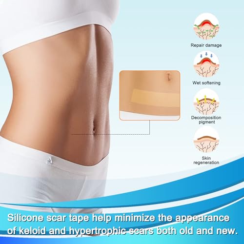 Medical Grade Silicone Scar Tape for Surgical Scars (1.6" x 120" - 3M) Professional Silicone Scar Sheets Scar Treatment for Face Wrinkles, C Section Recovery, Keloid Bump Removal Silicone Scar Patches