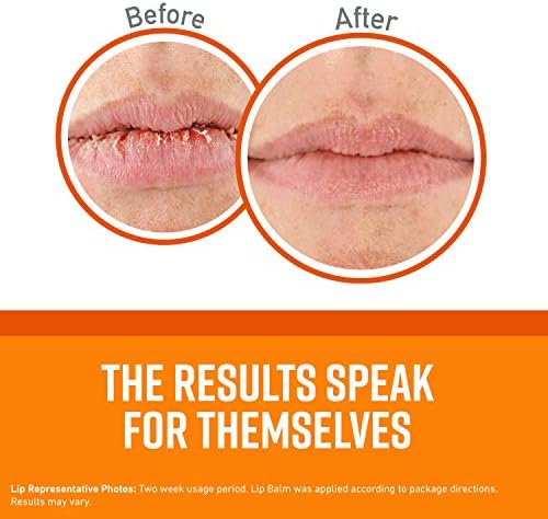 O'Keeffe's Lip Repair Lip Balm for Dry, Cracked Lips, Stick, (Pack of 3: 1 Cooling + 1 Unscented + 1 SPF)