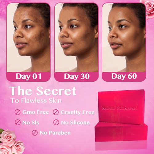 ROXIE'SBRAND Kojic Acid Dark Spot Remover Soap Bars with Vitamin C, Retinol, Turmeric - Original Japanese Complex Infused with Hyaluronic Acid, Shea Butter, Castile Olive Oil (2 x 3.52oz. Bars)