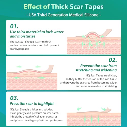 Silicone Scar Sheets, Medical Grade Silicone Scar Tape, Scar Removal Strips for Acne Scars C-Section & Keloid Surgery Scars Sheets Treatment Sheets -1.6"x 60" Roll-1.5M