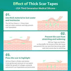Silicone Scar Sheets, Medical Grade Silicone Scar Tape, Scar Removal Strips for Acne Scars C-Section & Keloid Surgery Scars Sheets Treatment Sheets -1.6"x 60" Roll-1.5M