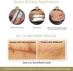 Embrace Active Scar Defense for New Tummy Tuck Scars, FDA-Cleared Extra-Large Silicone Scar Sheets, 30 Day Supply